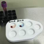 Анализ крови на определение группы крови расшифровка